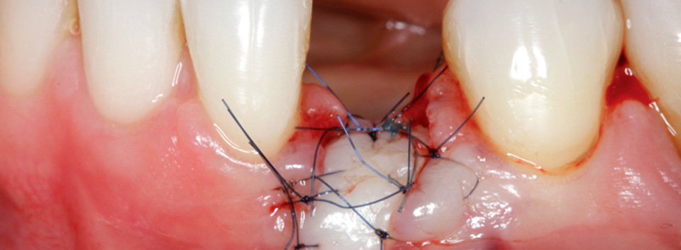 Image gallery marquee