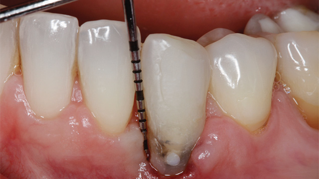 Image gallery marquee