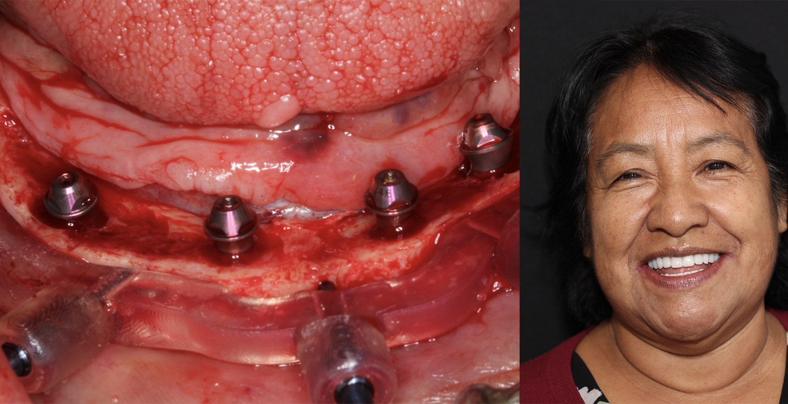 Image gallery marquee