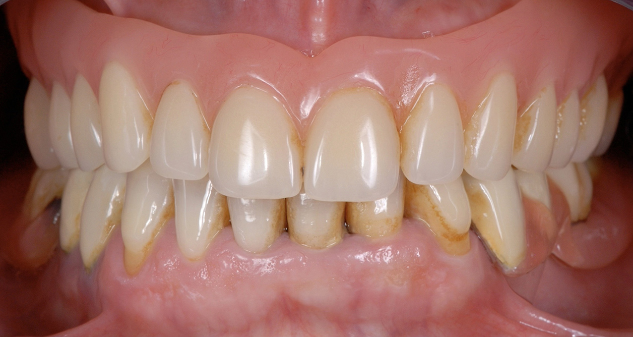 Image gallery marquee