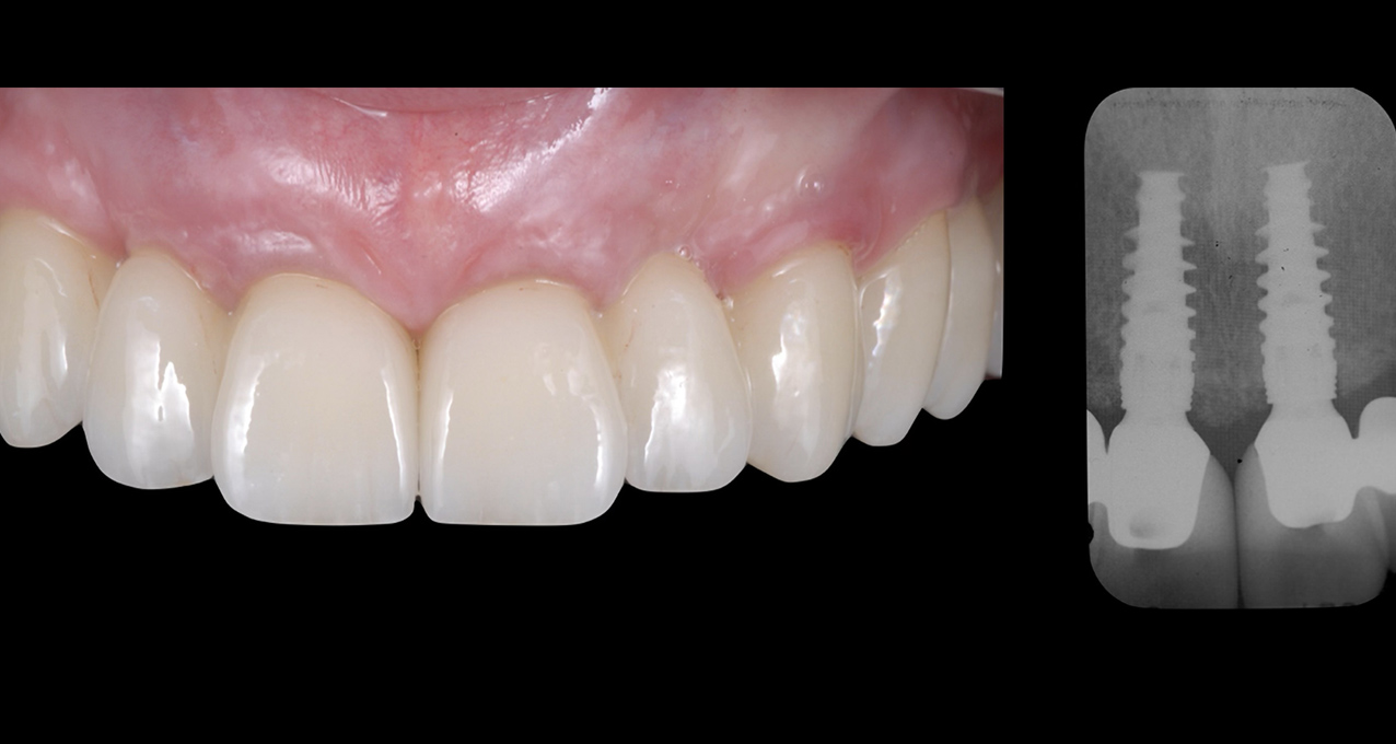 Image gallery marquee