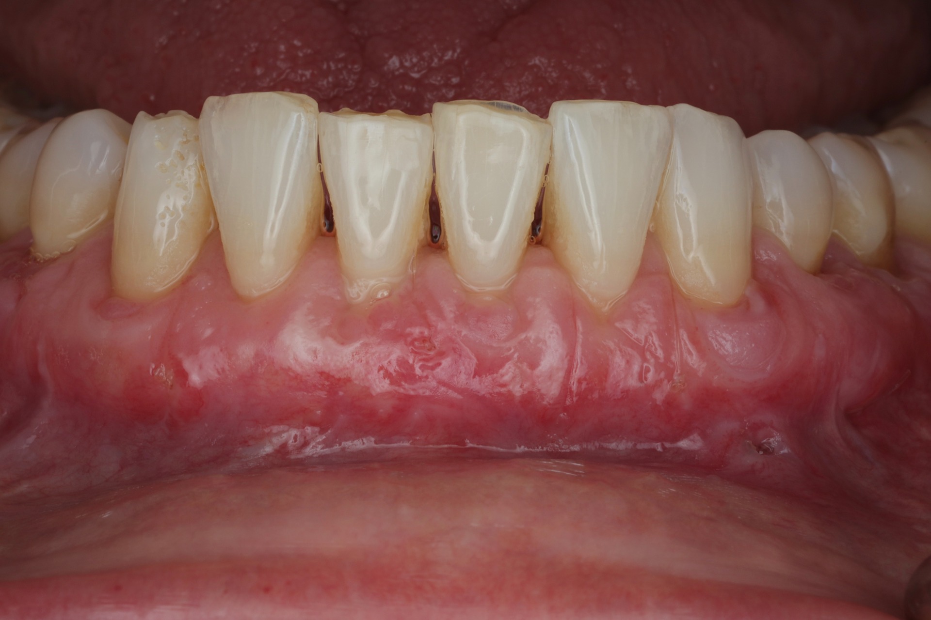 Image gallery marquee