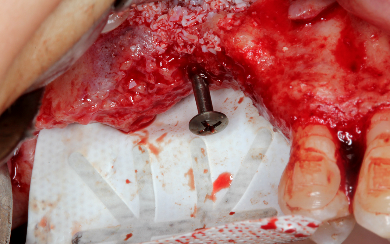 Image gallery marquee