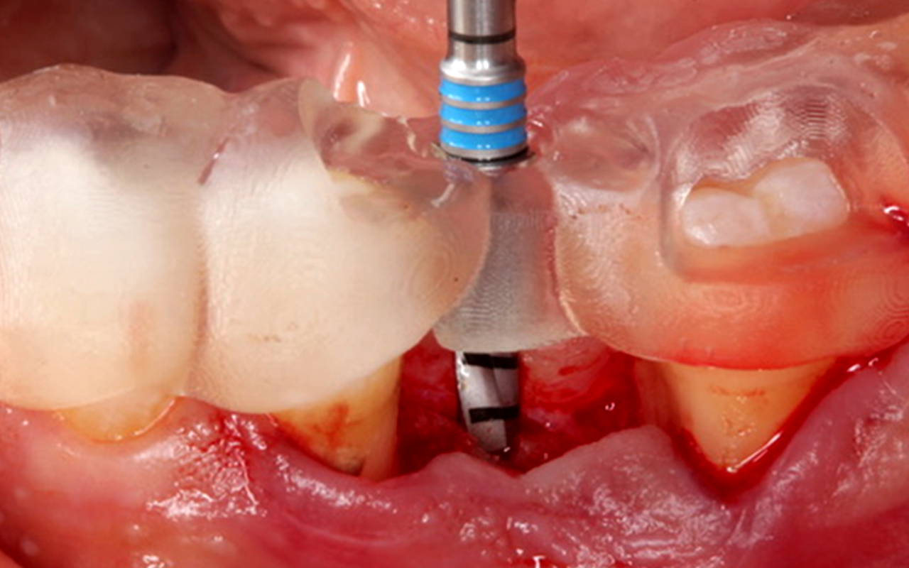 Image gallery marquee