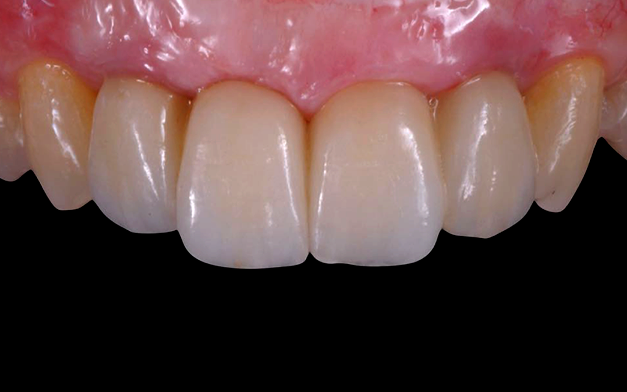 Image gallery marquee