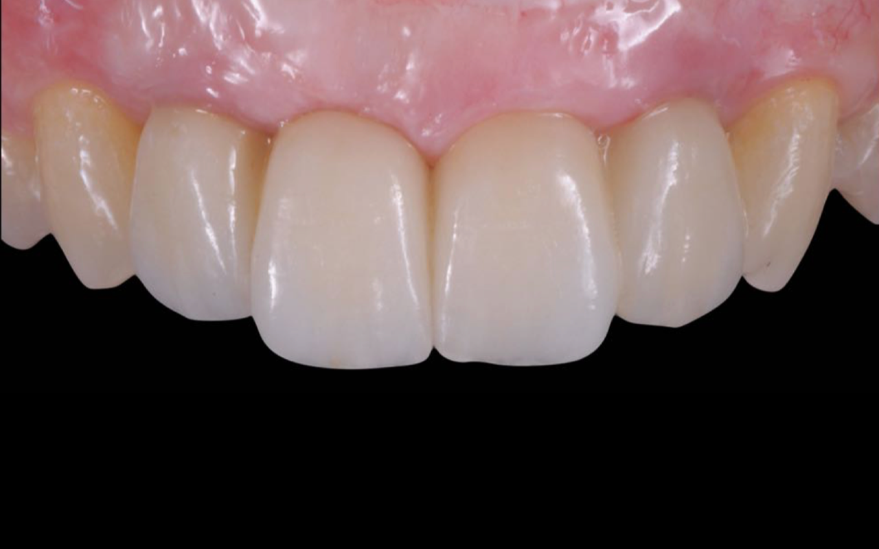 Image gallery marquee