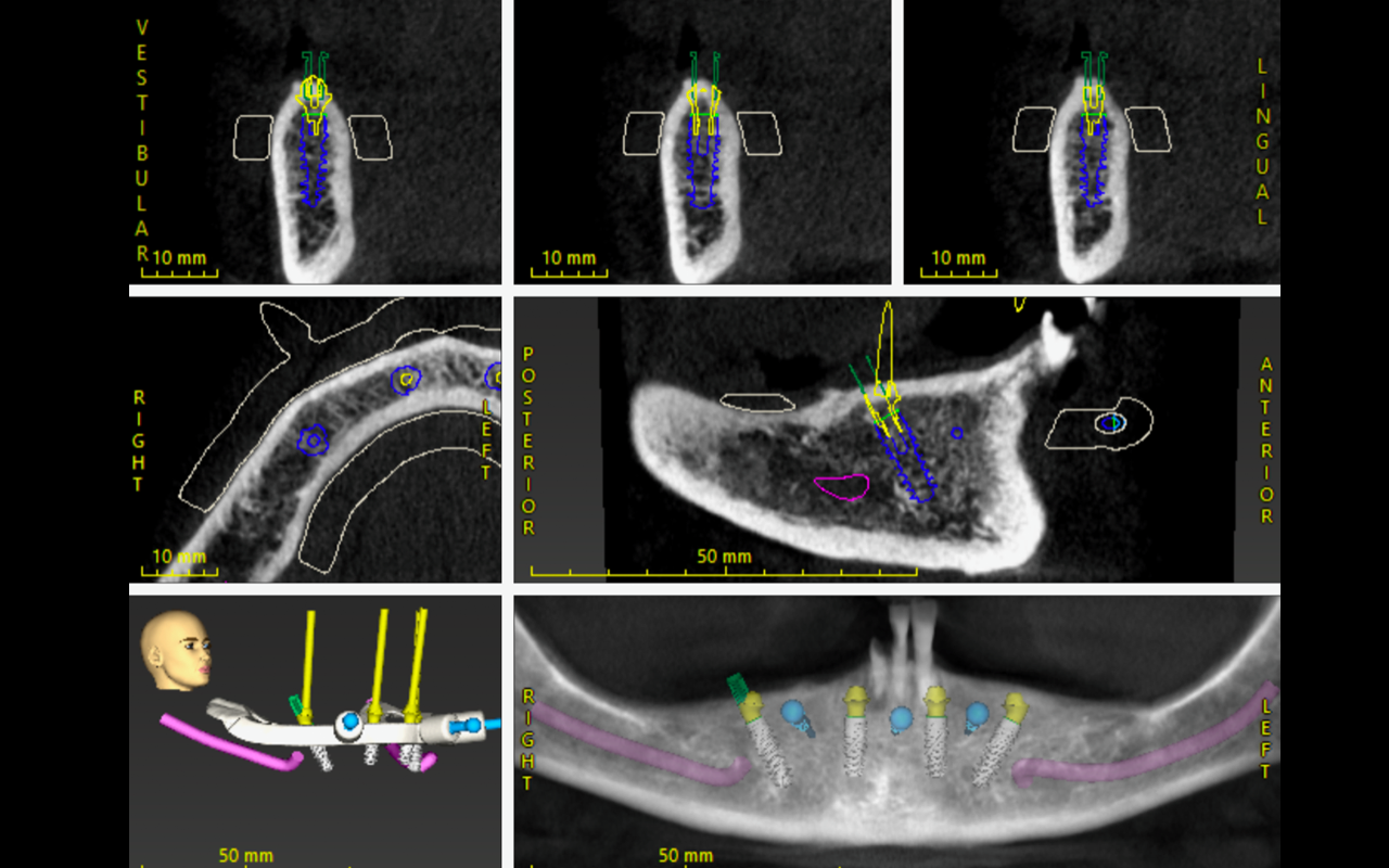 Image gallery marquee