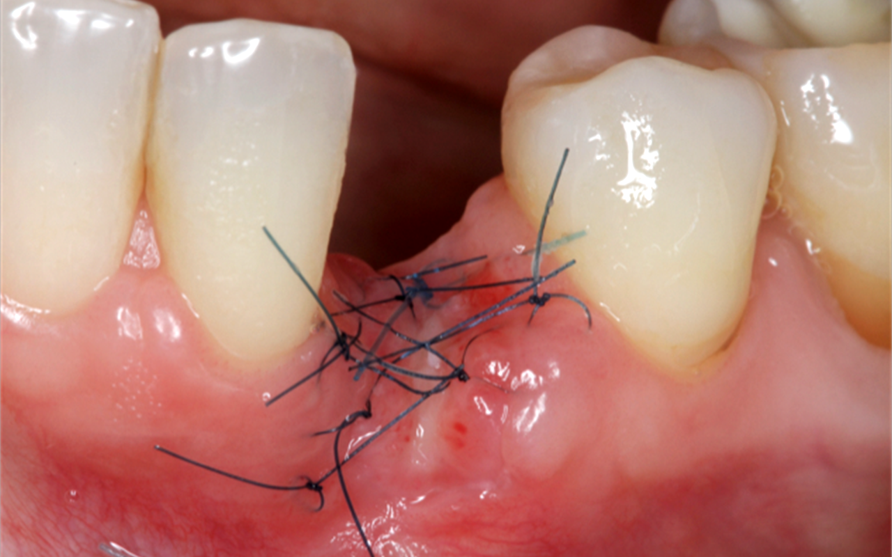 Image gallery marquee