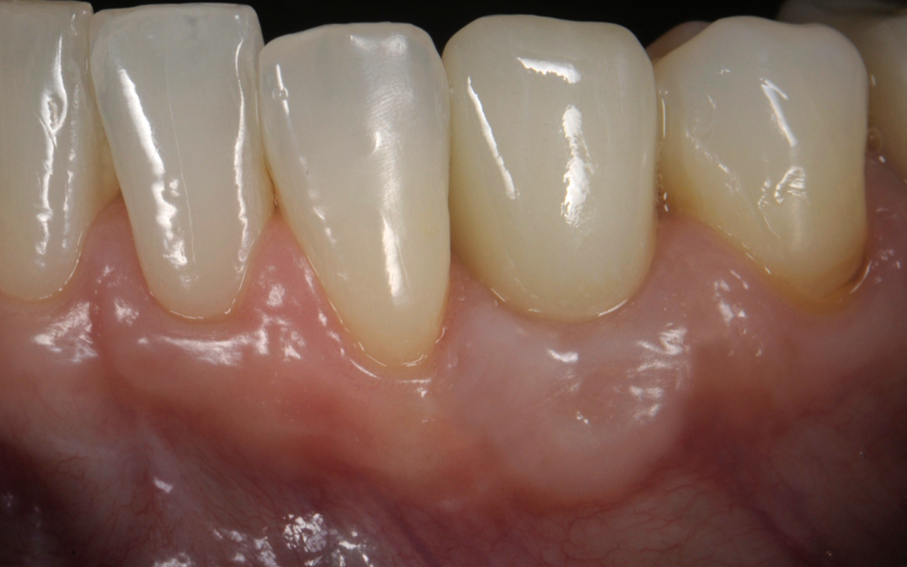 Image gallery marquee