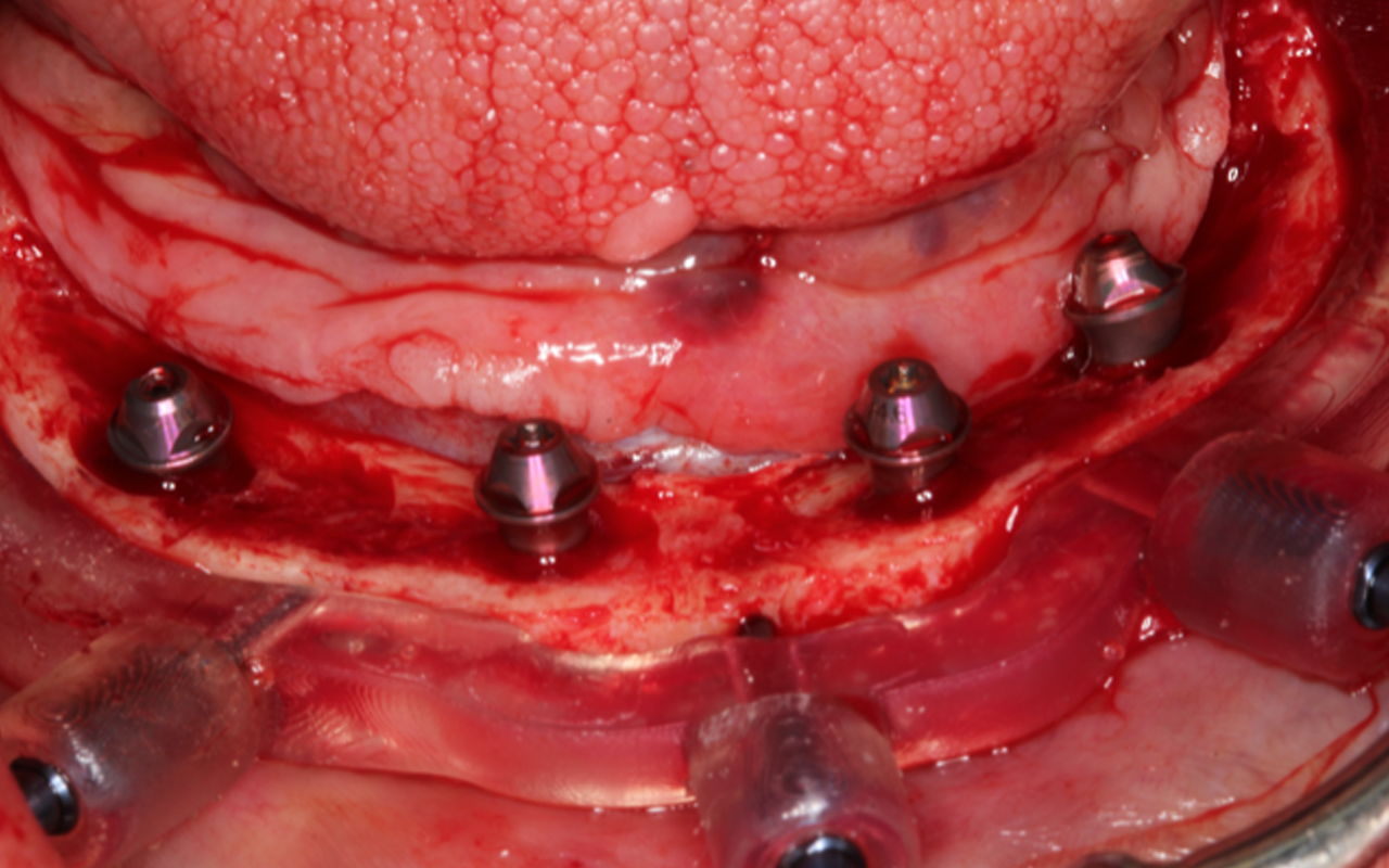 Image gallery marquee